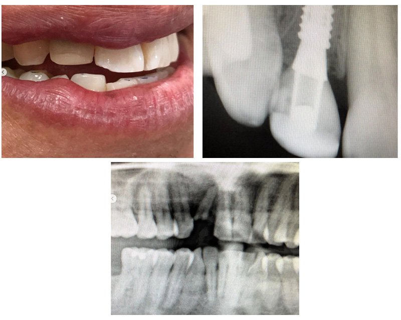 Georgetown Dentist