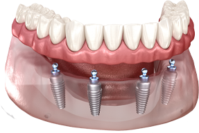 Georgetown Dentist