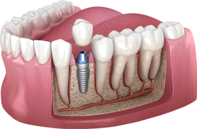 Georgetown Dentist
