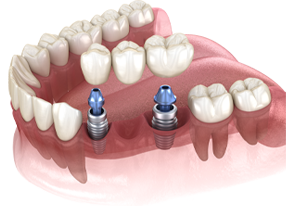 Georgetown Dentist