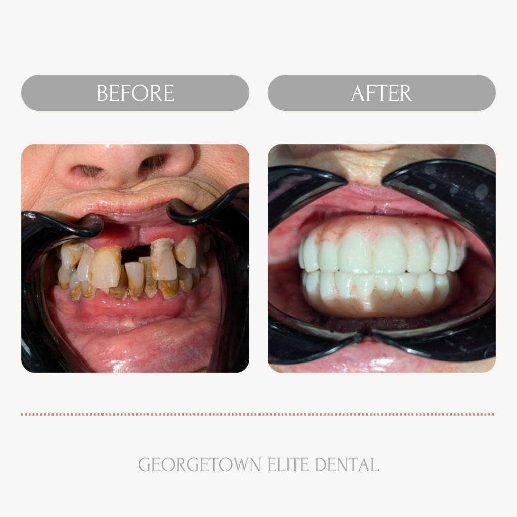 Georgetown Dentist